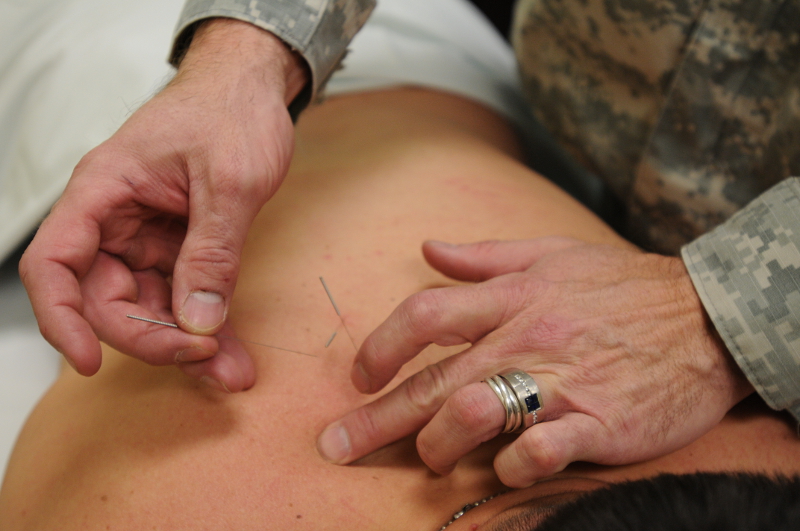 Acupuncture Back Pain