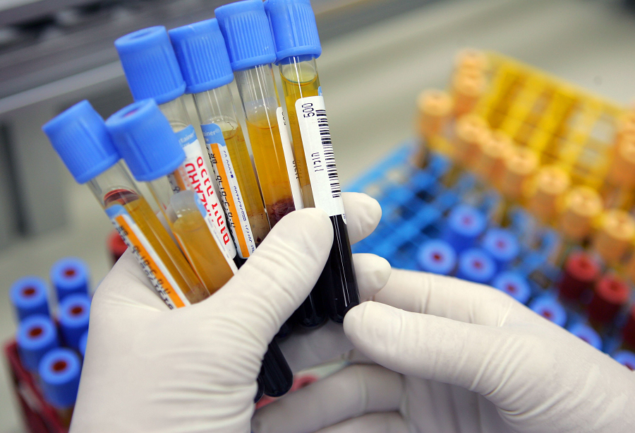 Blood test can detect aging process