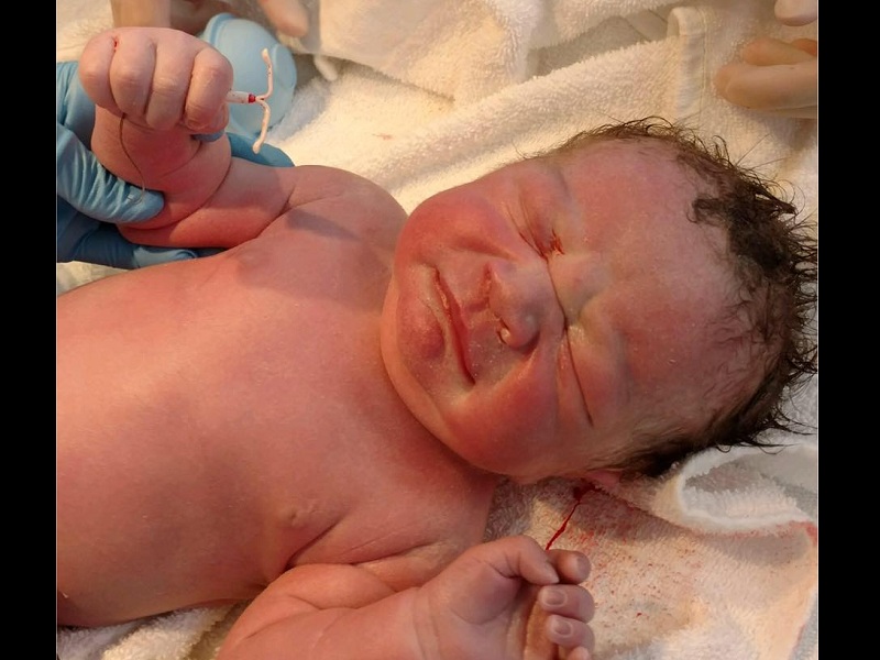 baby born holding iud