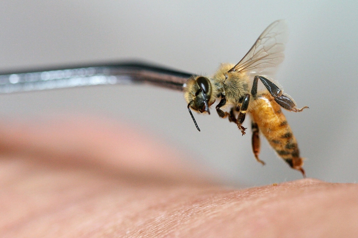 Bee acupuncture