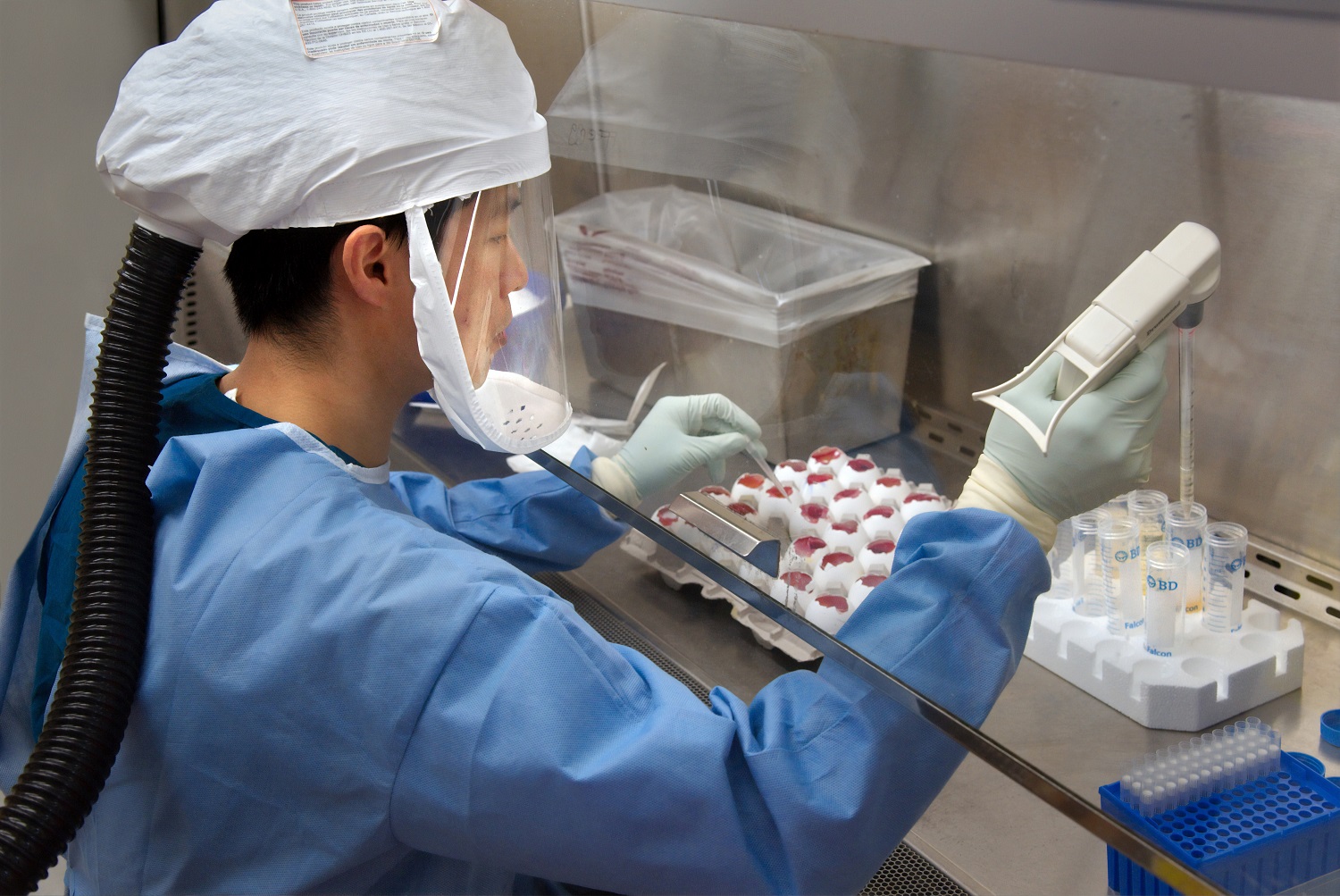 Bioengineering causes Wuhan Coronavirus