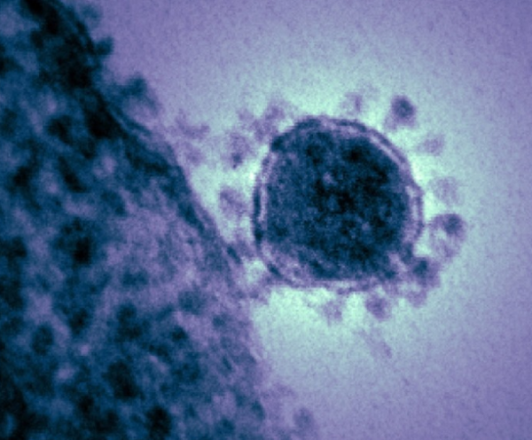 NEW VIRUS FOUND! What We Know about the Yaravirus Versus What We Know about the Coronavirus is Alarming