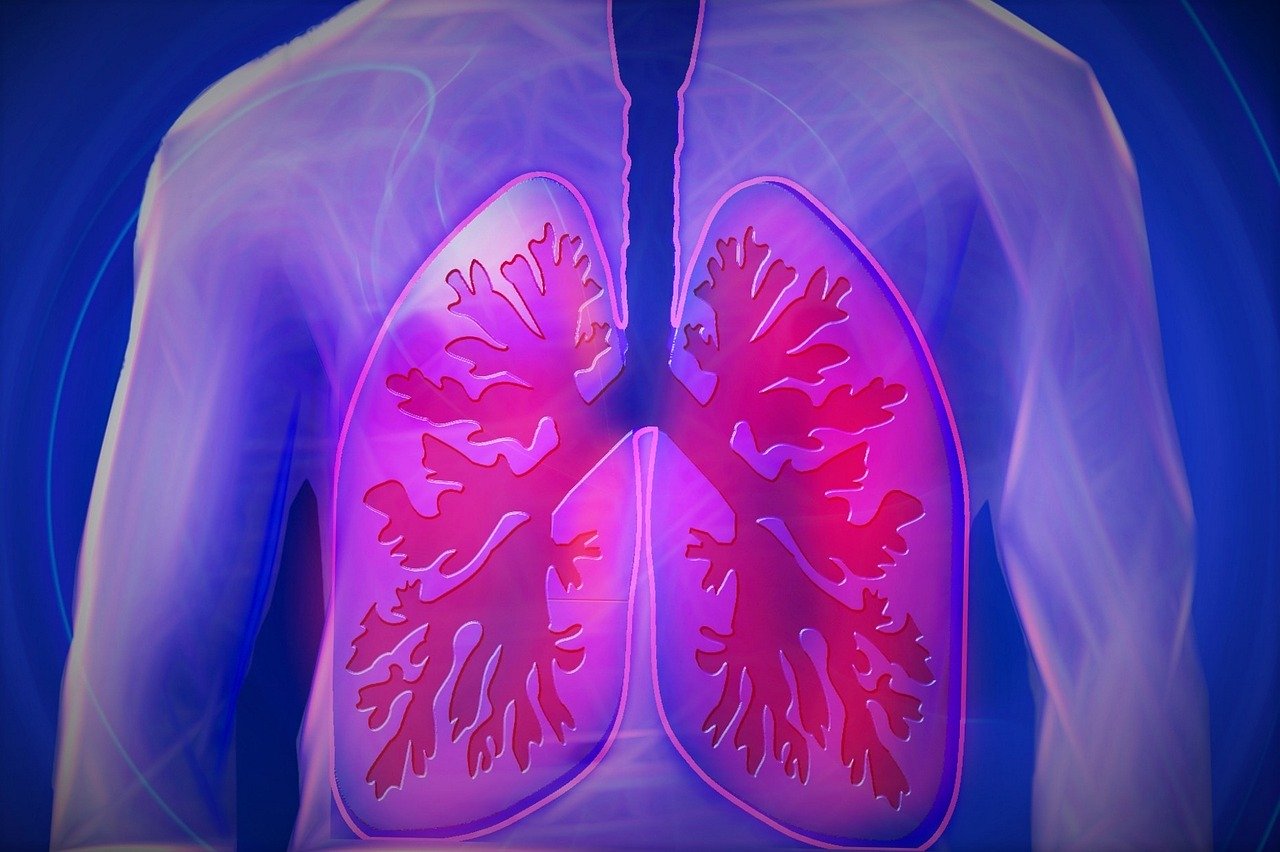 Expert Answers: How Does Coronavirus Affect Our Lungs?
