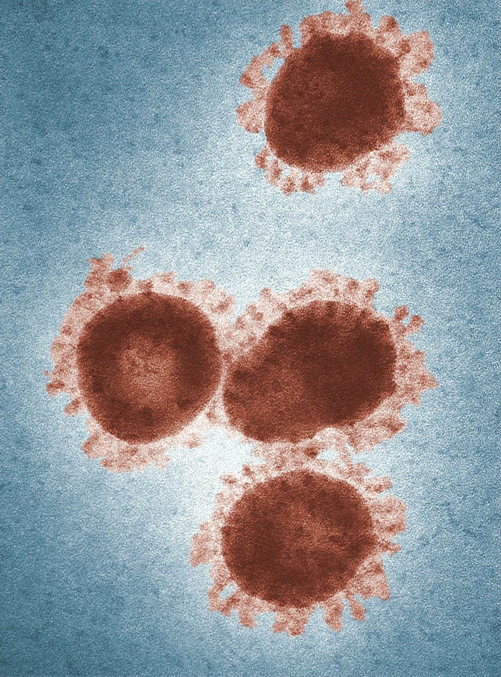 DIY Coronavirus Antibody Kits to Arrive in the UK 'Within Days,' PHE Confirms