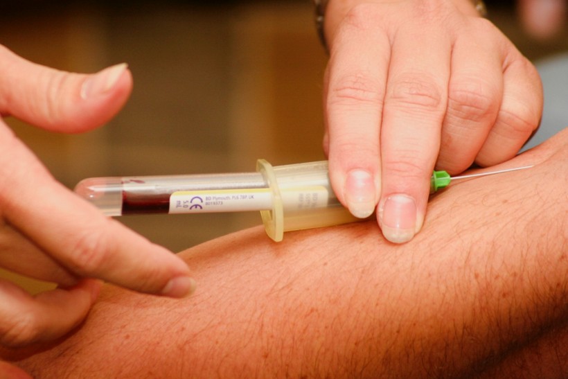 FDA Says Yes! First Coronavirus Test to Use Blood in Knowing Who's Infected or Not, Now OK to Use 