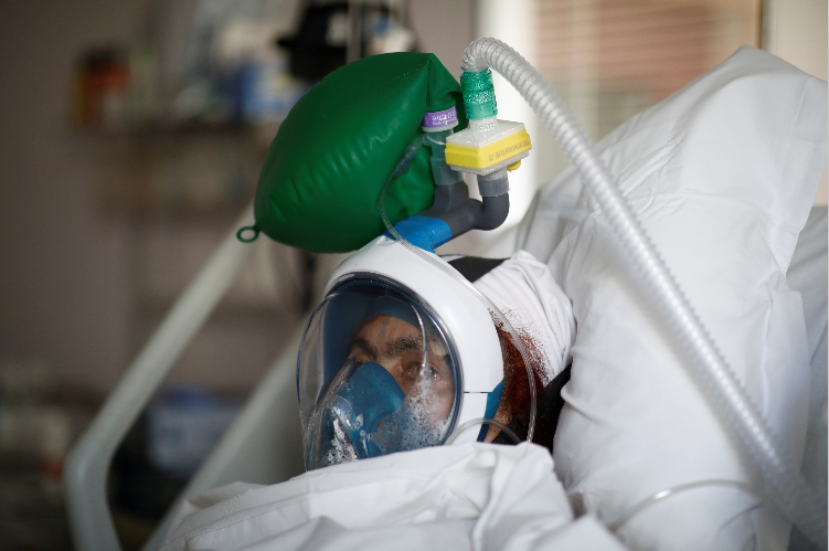 80% Dies in Coronavirus Due to Using Ventilators Reveal Studies 