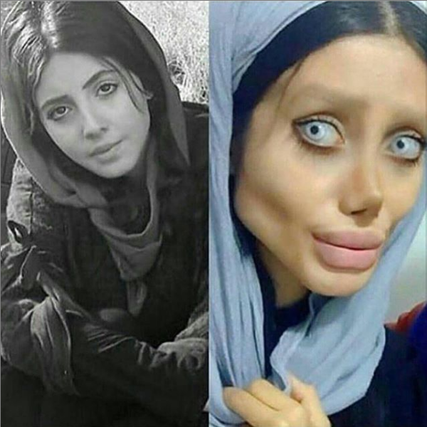 sahar tabar before and after 
