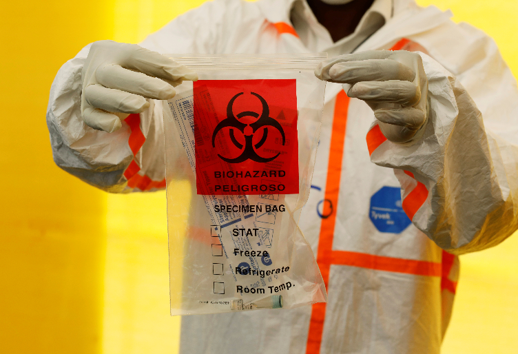 Coronavirus Update: US-Approved Abbott Testing Kit Admits 15% False Negative Results May Happen 