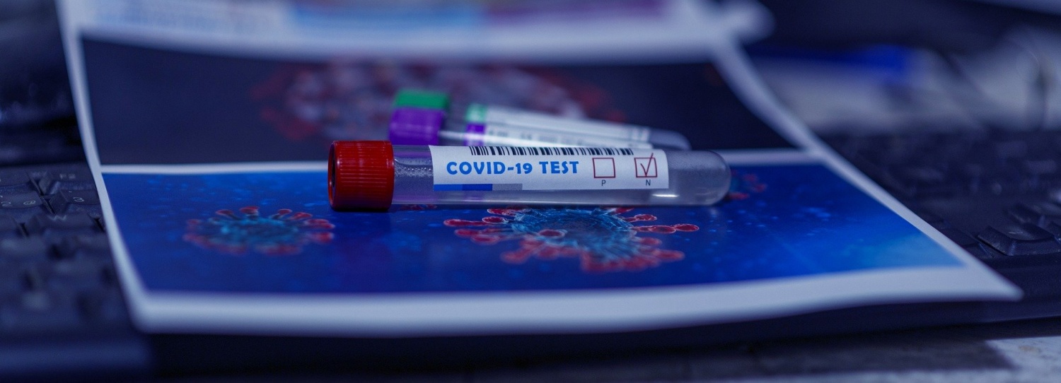 COVID-19 coronavirus rare inflammatory syndrome Kawasaki disease