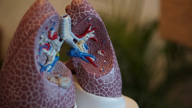 一个名为WLBU2的新抗生素的开发;专家说它与机械通气相关肺部感染能够对抗