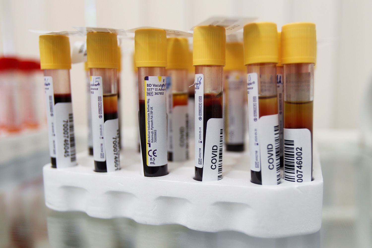 Vials with blood samples are pictured at a clinic providing testing for the coronavirus disease (COVID-19) and antibodies in Moscow