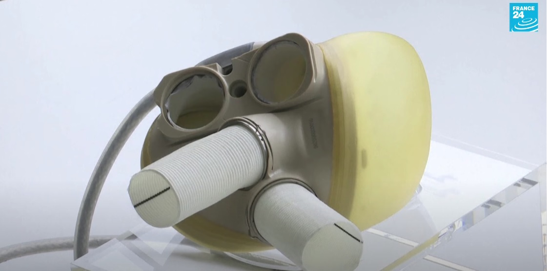 Carmat Artificial Heart: How This Biotech Invention Mimics a Real Human Heart
