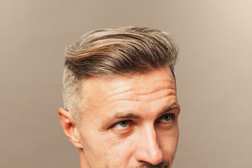 Liquid solution for hair loss: Topical Finasteride