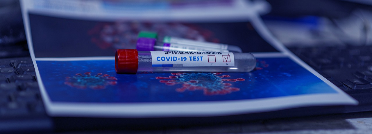 Private Coronavirus Tests: How They Work, Where To Get One, and the Cost