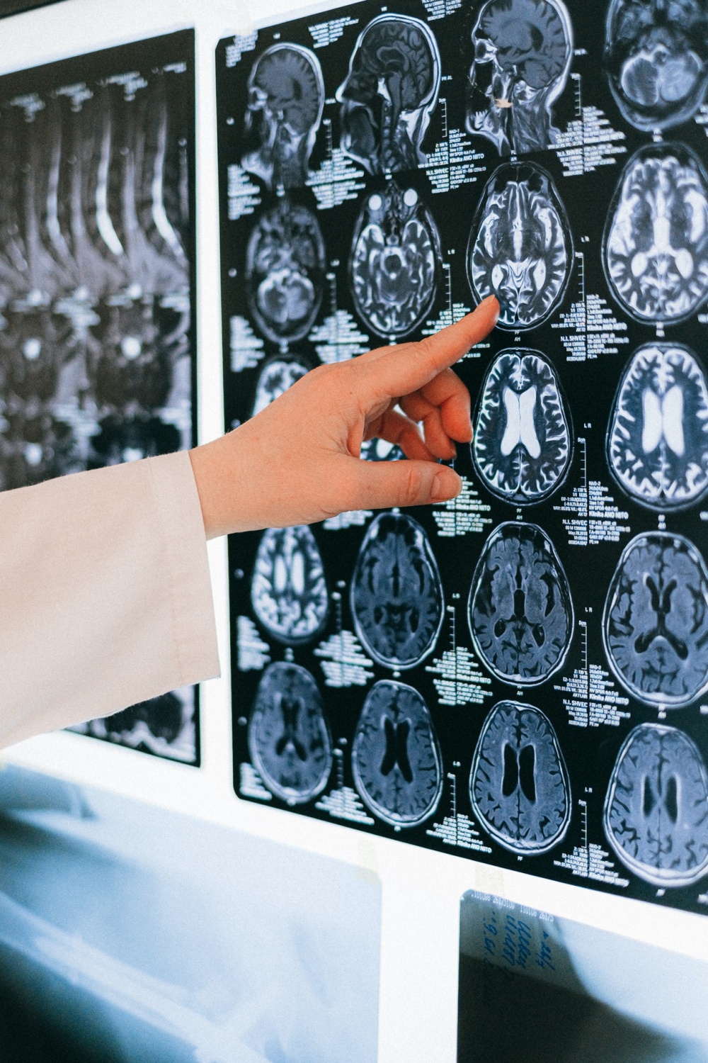 5 Pro Tips To Search For a Quality Neurologist