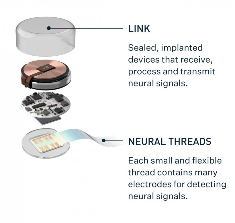The Neuralink Implant