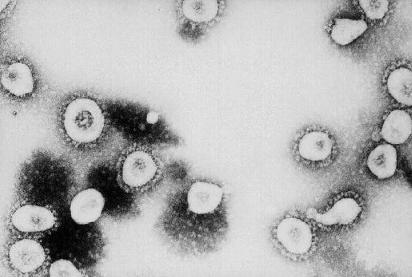 New Nanotech Claimed to be Effective Against Antibiotic-Resistant Viruses: Can It Help COVID-19 Patients? 