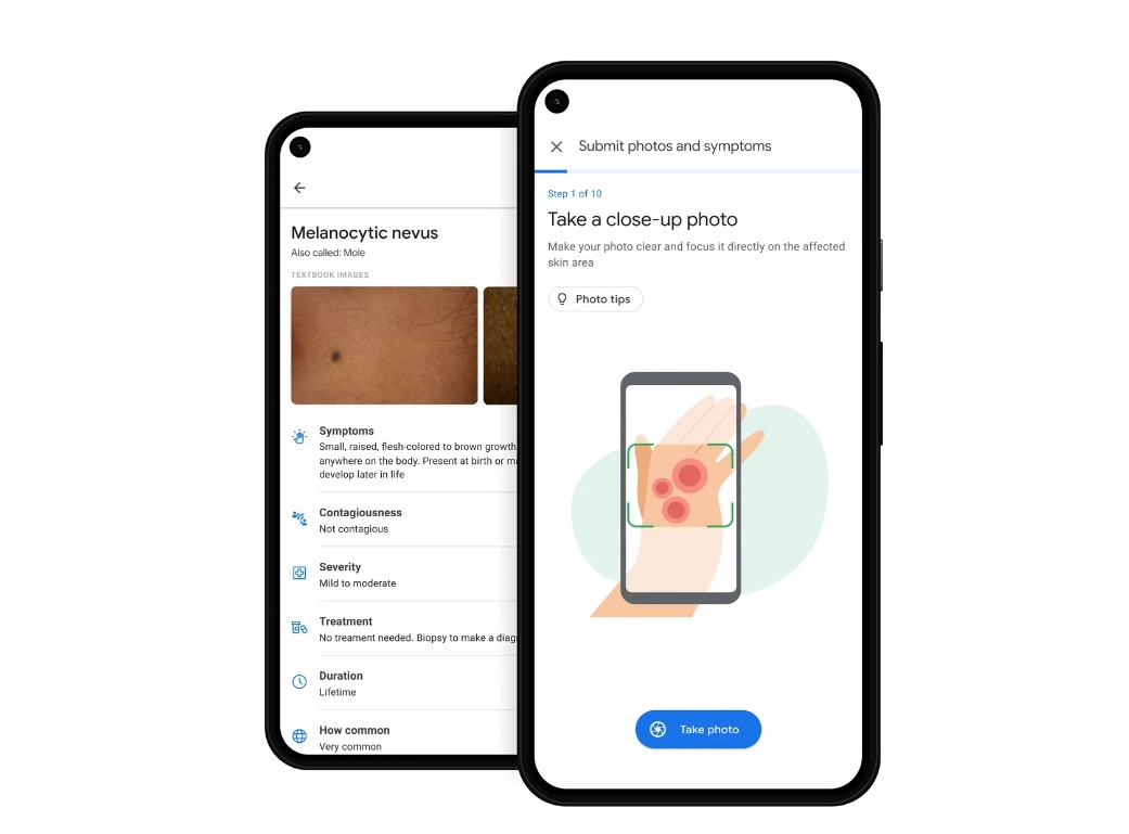 New Google AI Tool Can Assist Dermatologists in Detecting Skin Problems Among Patients