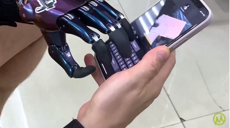 A Functional Prosthetic Hand Using a Smartphone Touchscreen
