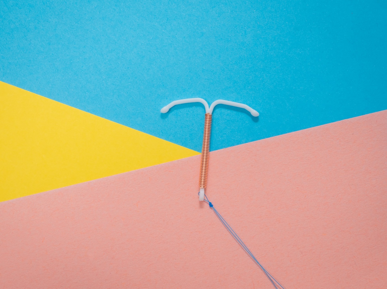 Tiktok Trend: Women Share Videos of Them Removing IUDs, But is it Safe?