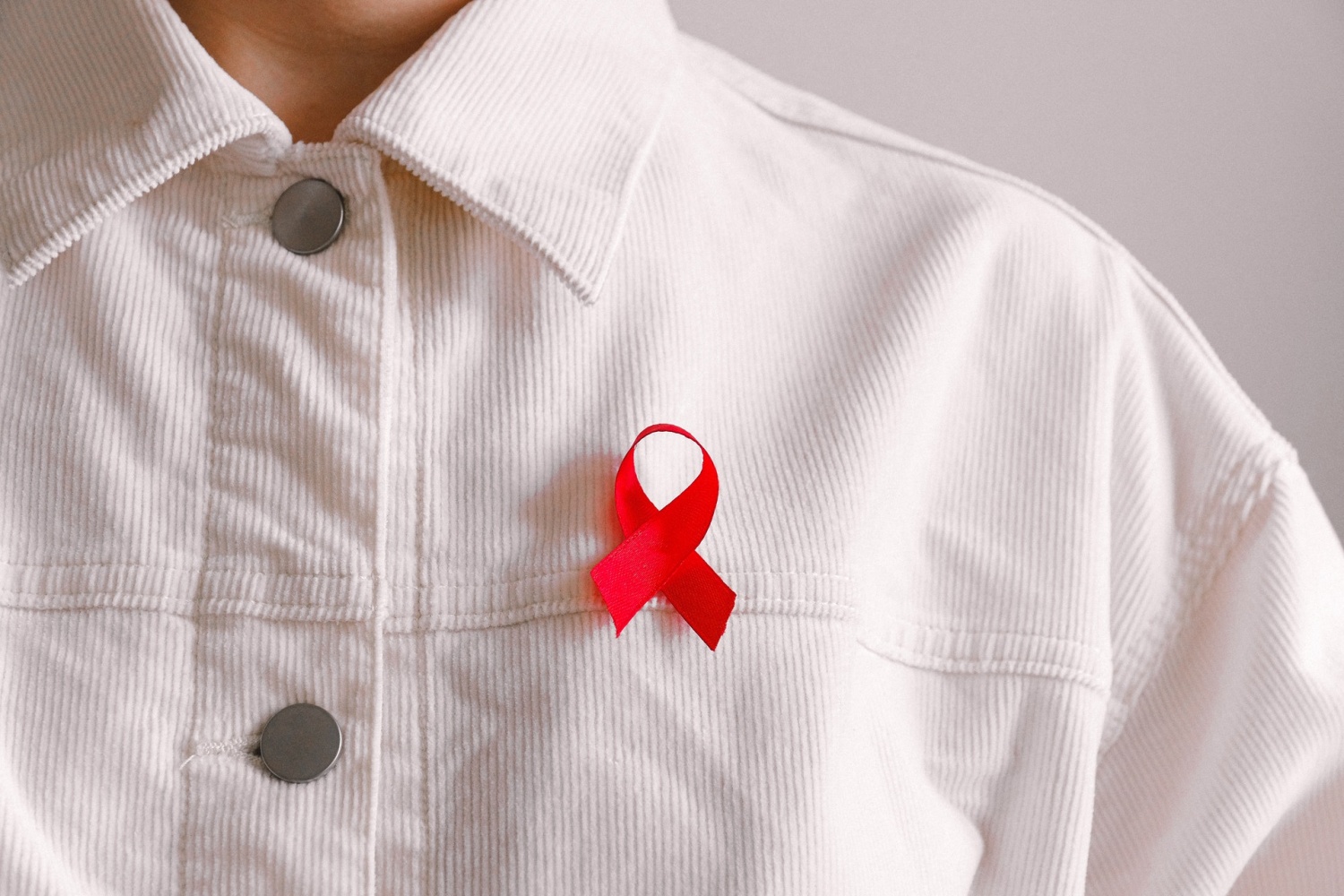 埃斯佩朗萨病人是第二位自然存活的艾滋病毒患者