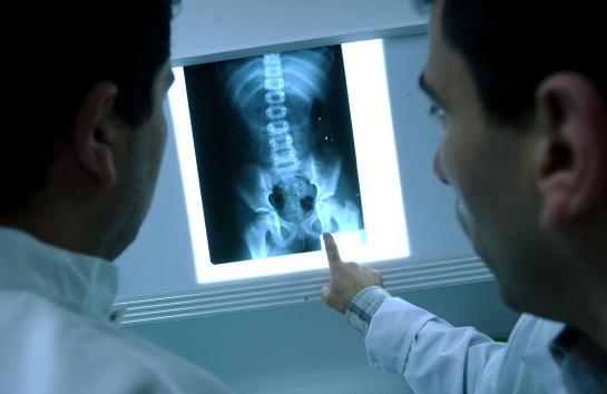 New AI Identifies Human Race Through X-Ray, CT Images? Experts Say It's 90% Accurate
