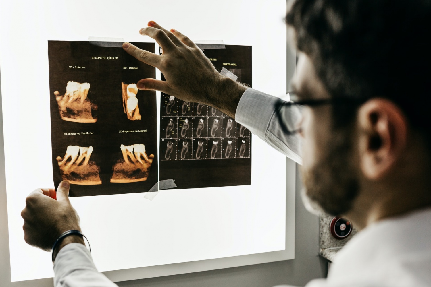 Artificial Intelligence to Help Analyze Dental X-rays for Better Comprehensive Care