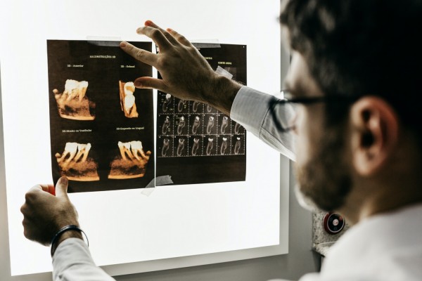牙科x光片接受人工智能帮助以更好地理解