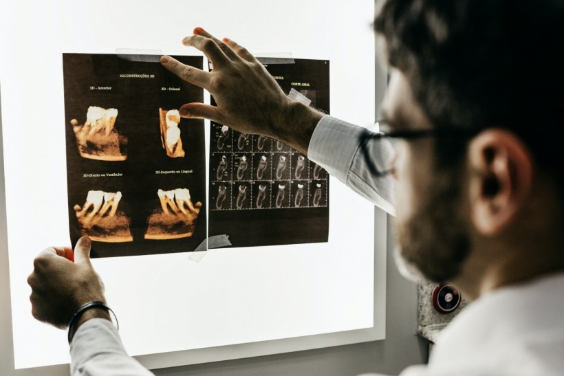 Dental X-ray receives AI Help for Better Understanding
