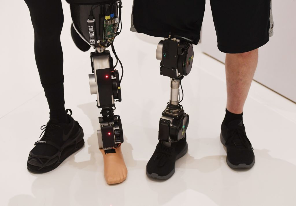 ISRO Creates Lightweight Prosthetic Limbs — Also Ten Times Cheaper Than Most Bionic Limbs
