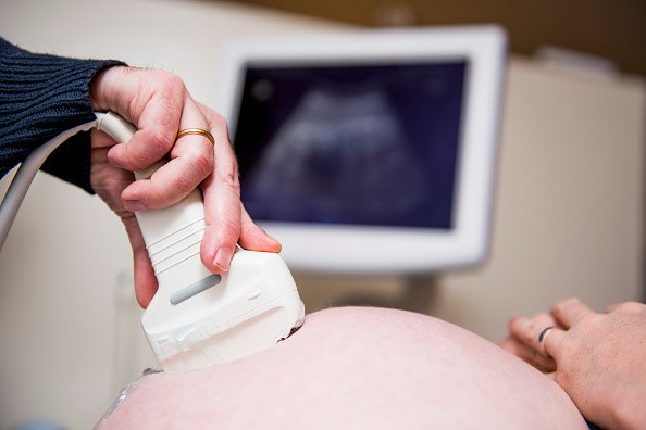 Google Works on New Low-Cost AI Ultrasound; Here's How It Can Improve Maternal Health