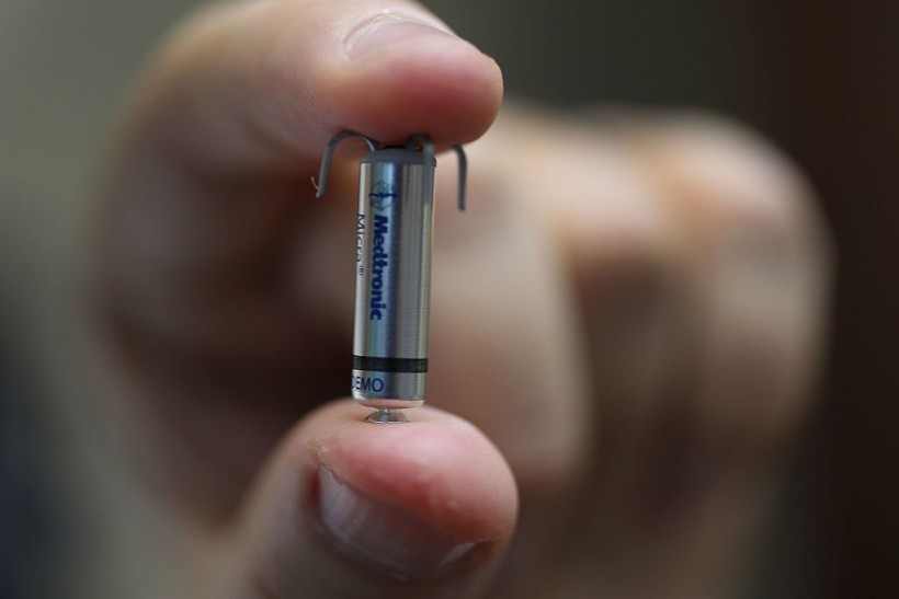 World's Smallest Pacemaker Saves Life Of 78-Year-Old Patient