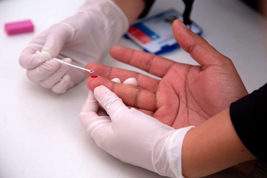 'Geneva Patient' Achieves Long-Term HIV Remission