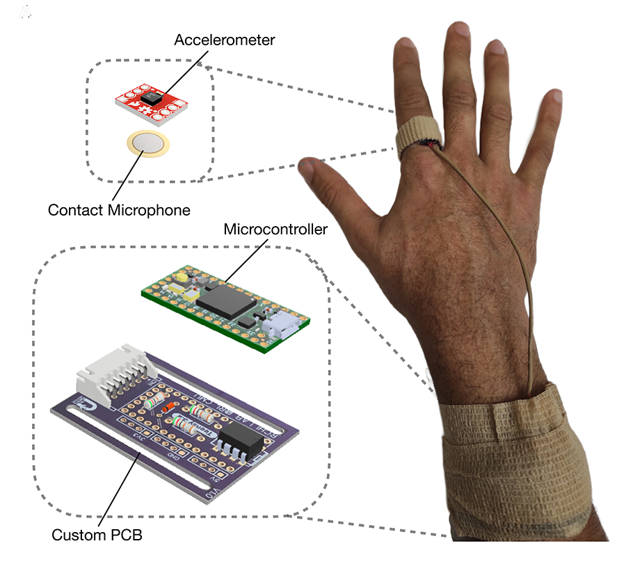 This New Finger-Worn Device Can Incredibly Measure Scratching Intensity