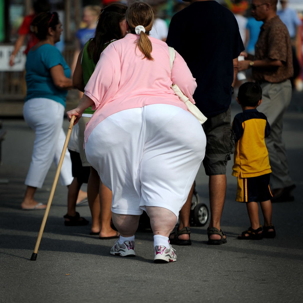 Surging Obesity Rates in US Raise Alarms: 22 States Hit 35% or Higher, Says CDC