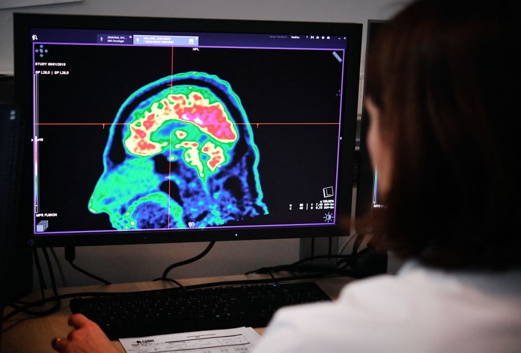 Medicare Lifts Lifetime Limit on PET Scans, Expanding Alzheimer's Diagnosis Options