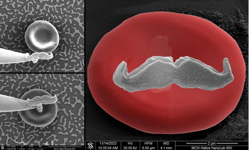 Australian scientists give red blood cell world’s tiniest Mo