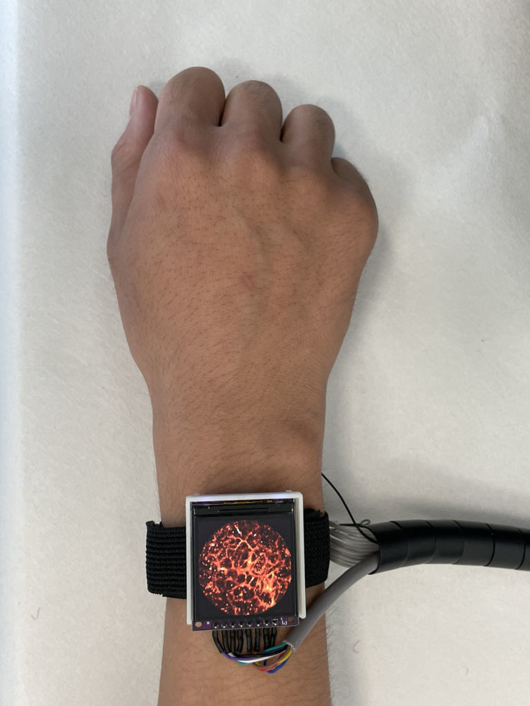 Wearable tech captures real-time hemodynamics on the go
