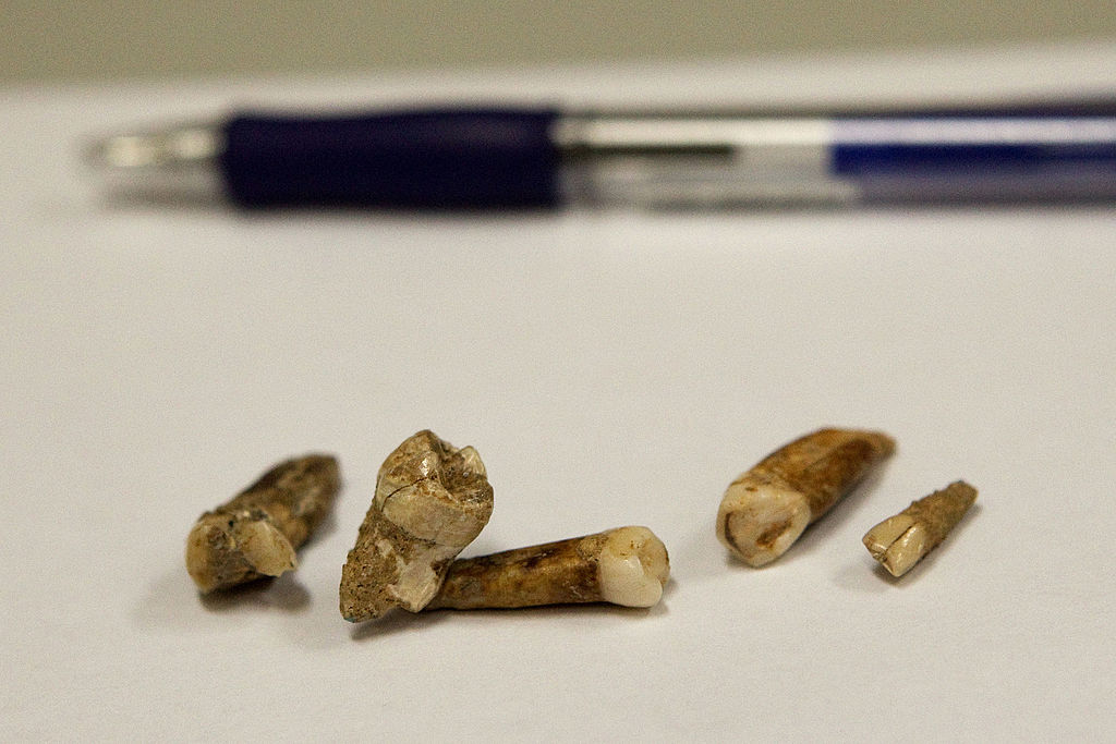 Ancient teeth that were discovered at an